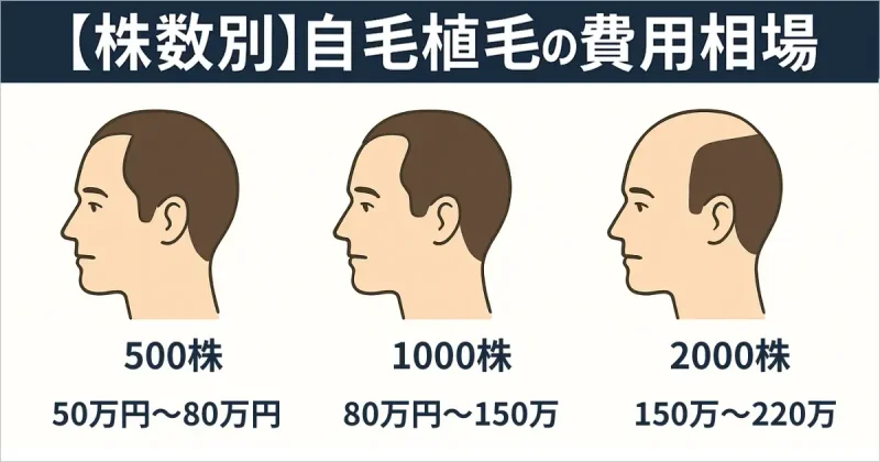 自毛植毛の費用相場